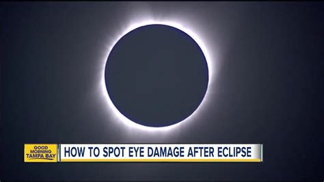 Solar eclipse: Eye damage can show later [Video]