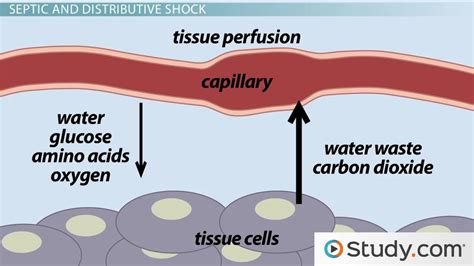 Hypovolemic & Septic Shock: Causes & Treatment - Video & Lesson ...