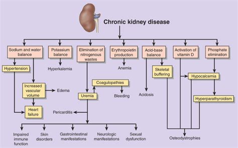 Opinions on Chronic kidney disease