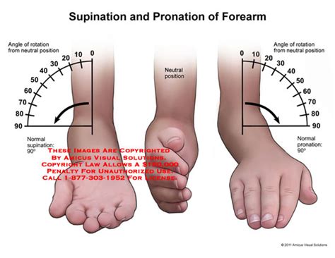 AMICUS Illustration of amicus,anatomy,range,motion,forearm,pronation,supination,angle,rotation ...