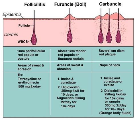 Fruncule / Boil vs Carbuncle ... See tried | Keratosis pilaris, Dermatology nurse, Dermatology