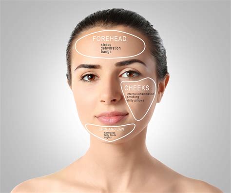 Acne Face Map: What Are Your Breakouts Telling You?