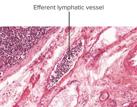 Secondary Lymphatic Organs | Concise Medical Knowledge