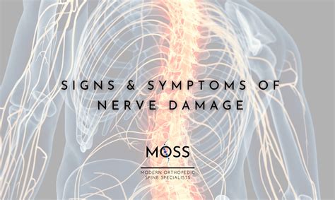 Signs & Symptoms of Nerve Damage - Modern Orthopedic Spine Specialists