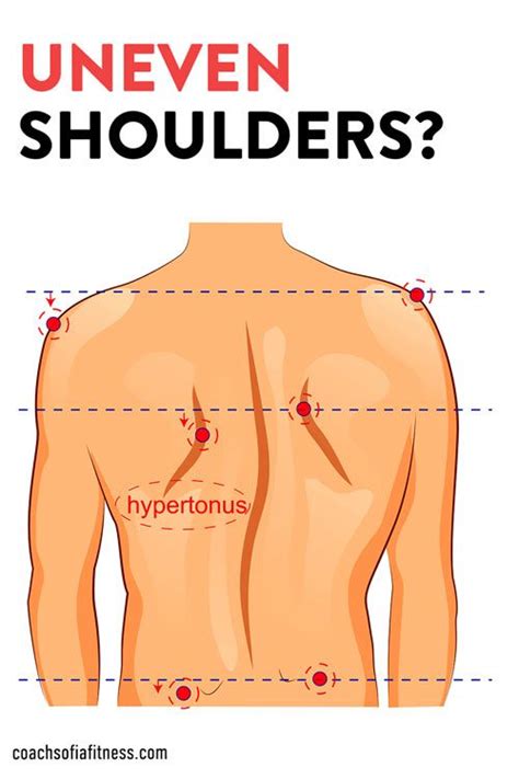 Uneven Shoulders: The Ultimate Guide - Coach Sofia Fitness