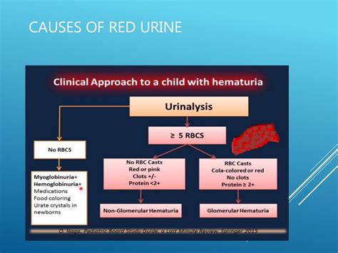 Hematuria in children