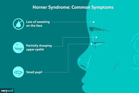 Is Horners Syndrome Fatal In Dogs