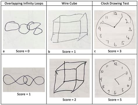 Geriatrics | Free Full-Text | Diagnostic Accuracy of the Overlapping Infinity Loops, Wire Cube ...