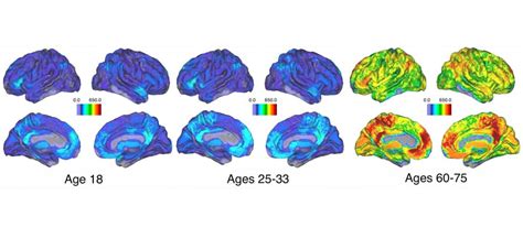 As people age, memory-related brain activity loses cohesion