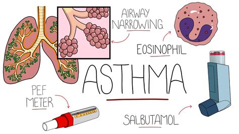 Asthma Drawing Easy