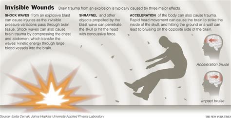 EMS SOLUTIONS INTERNATIONAL by @DrRamonReyesMD marca registrada: Blast ...