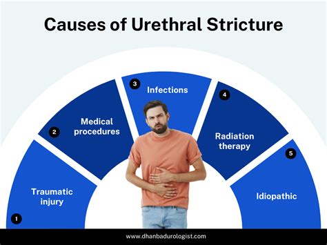 Urethral Stricture : Causes, Symptoms And Treatment Options | by Saketnarnoliurologist | Medium