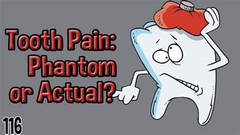 Phantom Tooth Pain, or Actual Pain? - YouTube