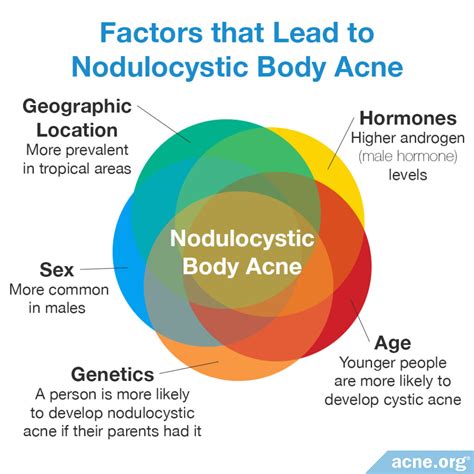 Cystic Acne on the Body - Acne.org