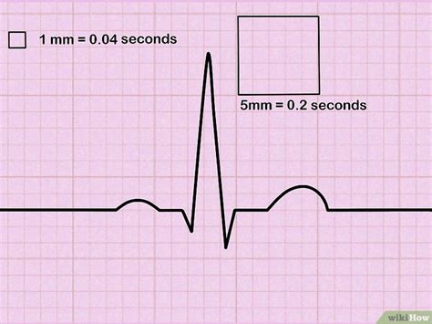 Cómo leer un electrocardiograma: 9 Pasos (con imágenes)