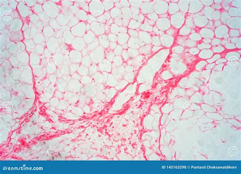 Human Fat Body Tissue Under Microscope View Stock Photo - Image of food ...