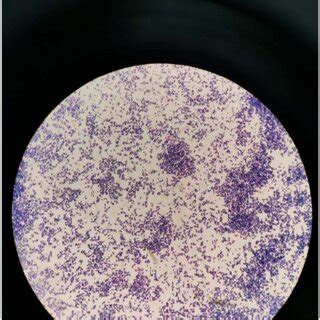 Result of pus culture showed Kocuria kristinae colony. | Download Scientific Diagram