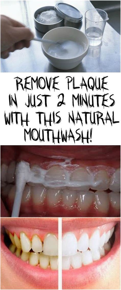 REMOVE PLAQUE IN JUST 2 MINUTES WITH THIS NATURAL MOUTHWASH! | Natural ...