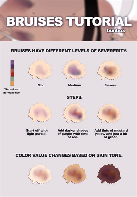 List Of Stages Of A Bruise Colors Article - CLUBCOLOR VGW