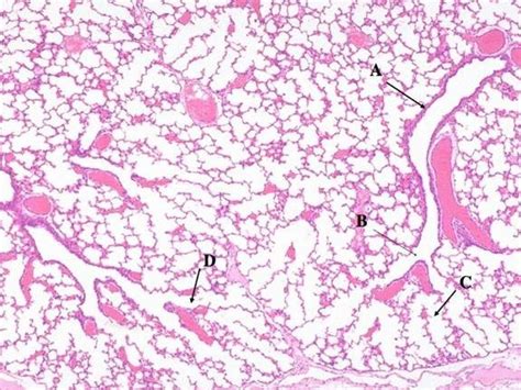 Terminal Bronchioles Histology