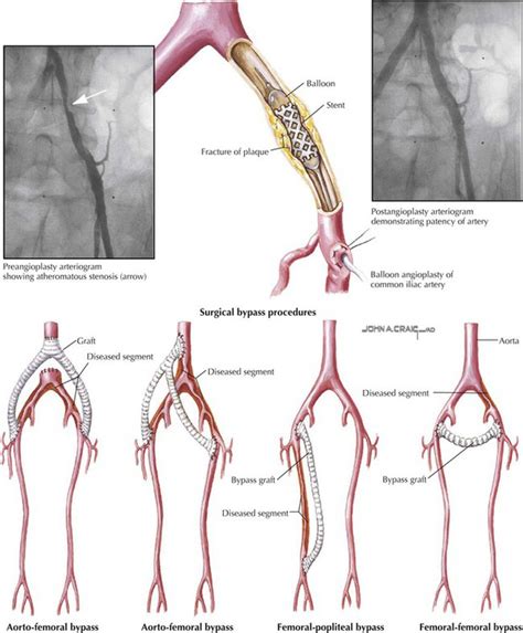 Lower Limb | Basicmedical Key