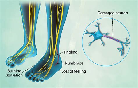 Health Condition : Symptoms, Causes, Treatment and More