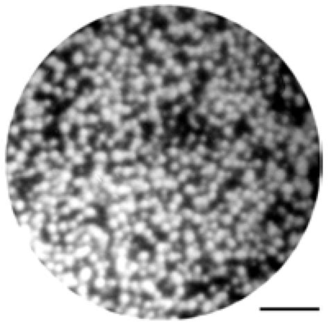 Metals | Special Issue : Amorphous Alloys