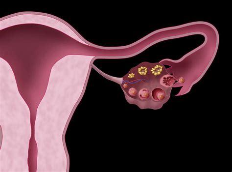 Ovarian Follicles, Illustration #1 Photograph by Monica Schroeder - Pixels