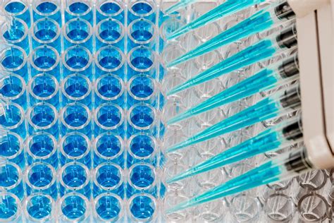 Enzyme-linked immunosorbent assay (ELISA) | Definition, Uses, & Method ...