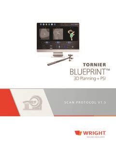 TORNIER BLUEPRINT / tornier-blueprint.pdf / PDF4PRO