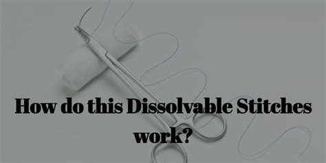 How do Dissolvable Stitches work?