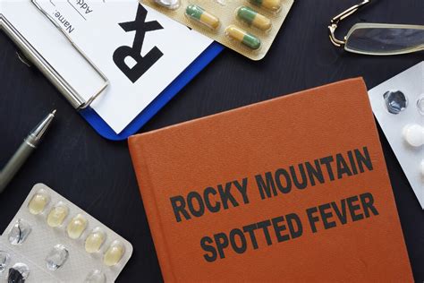 ROCKY MOUNTAIN SPOTTED FEVER