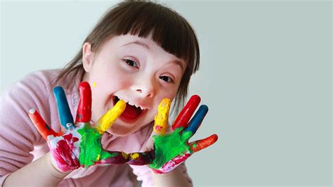 What is Down Syndrome What are Down Syndrome Symptoms