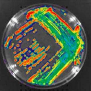 Bioluminescent Bacteria: Gram-Positive and Gram-Negative | PerkinElmer