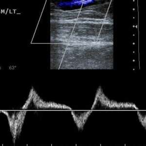 Venous Ultrasound Imaging course | Wessex Diagnostic