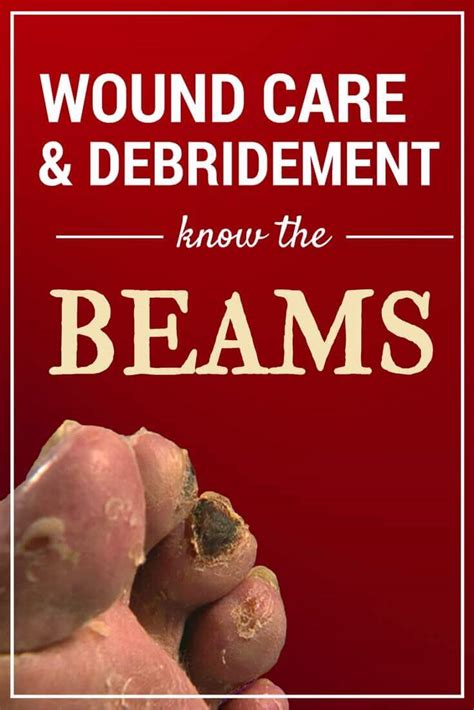 Wound Care and Debridement: Know the BEAMS - WCEI - Blog WCEI – Blog