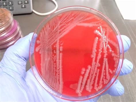 Bacteria on a plate | Microbiology, Microbiology lab, Biochemical