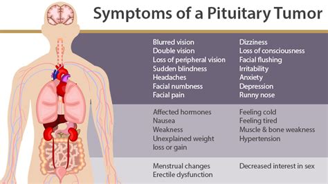 Pituitary Tumor