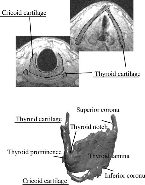 Figure 3 from Translation and rotation of the cricothyroid joint ...