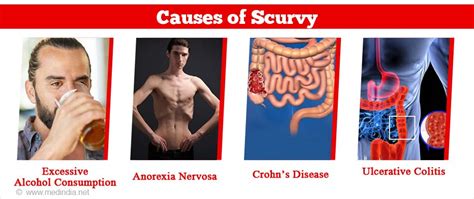 Scurvy Symptoms And Causes