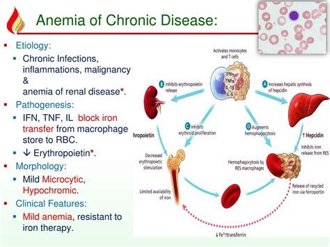 Causes for chronic anemia: Aplastic anemia – Symptoms & causes