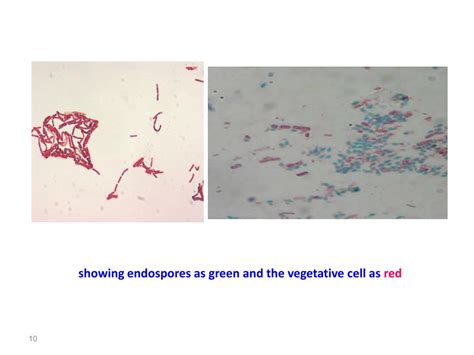 PPT - Diagnostic microbiology lecture: 11 Gram Positive, Endospore ...