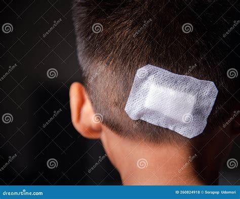 The Lacerated Suture Wound of Kid Back Head Which Suture with Trauma the Head by Medical Bandage ...