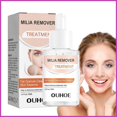 Milia Removal Tool 30ml Lightweight Milia Fat Granules Removal Essence Liquid Milia Spot Repair ...