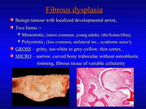 Premalignant lesions