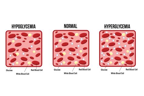 Hyperglycemia vs. Hypoglycemia | Lark Health