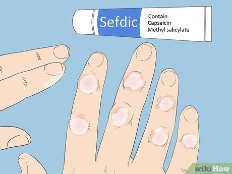 12 Ways to Get Rid of Arthritis Bumps on Fingers - wikiHow