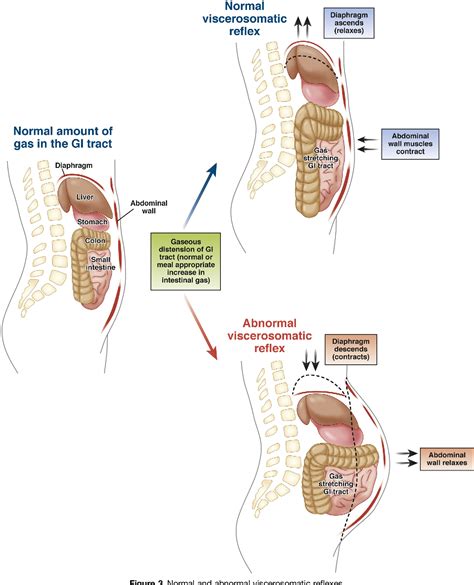 Table 1 from Management of Chronic Abdominal Distension and Bloating. | Semantic Scholar