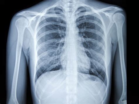 Ask Dr. M: What’s the difference between an X-ray, CT scan, ultrasound ...