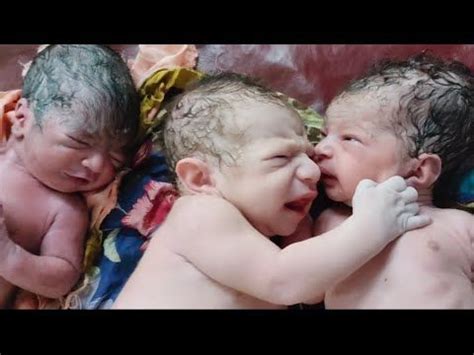 Triplets newborn babies immediately after birth with first cry of life born with ovulation ...